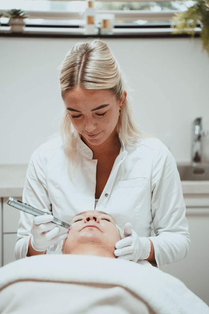 Dermapen behandeling Hoeksche Waard