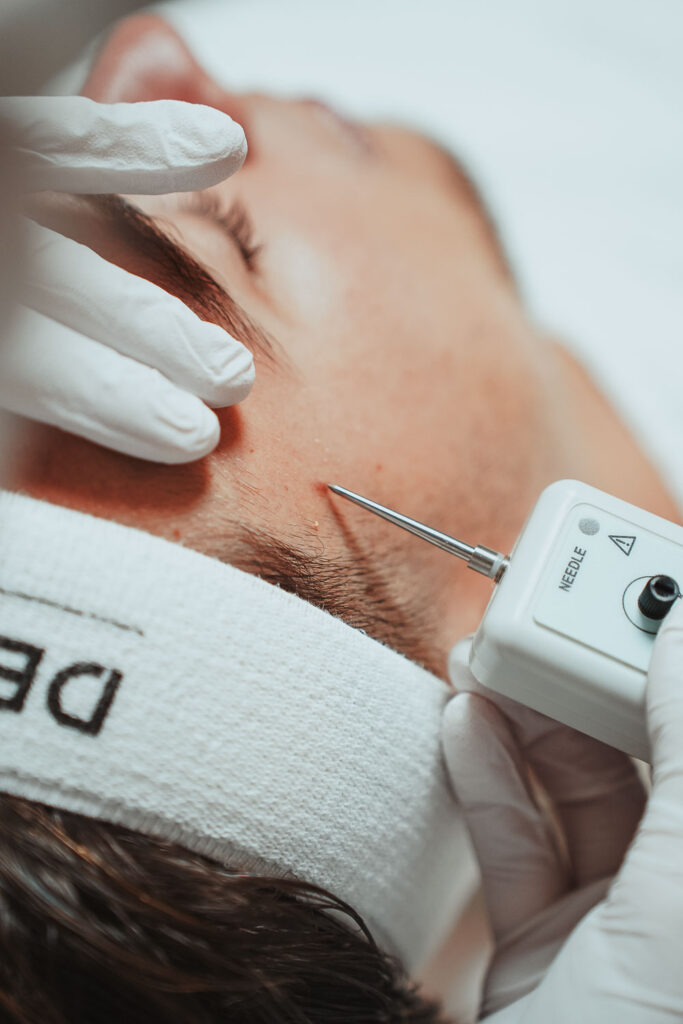 Specialistische huidtherapie gezicht