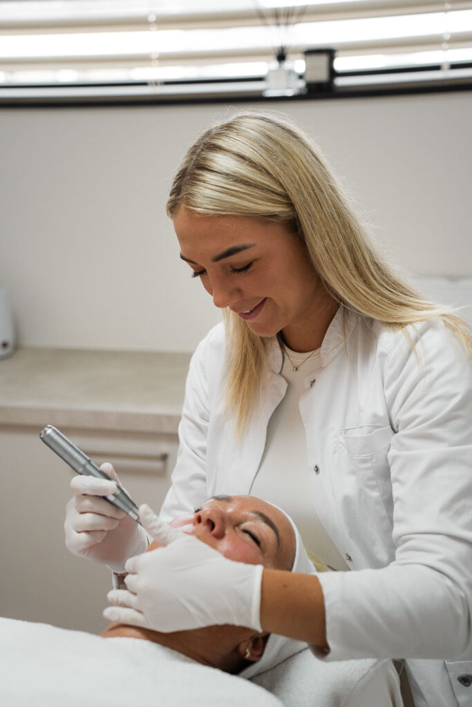 Microneedling behandeling bij VeraLune