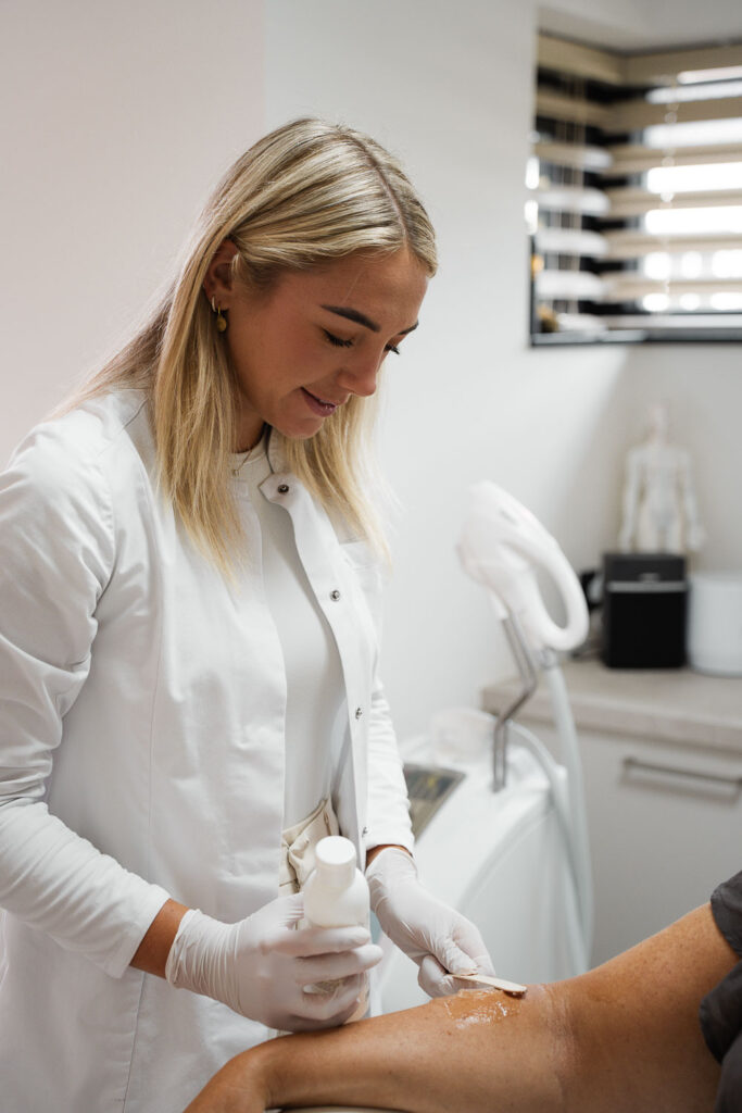 IPL behandeling tegen pigmentvlekken op de huid