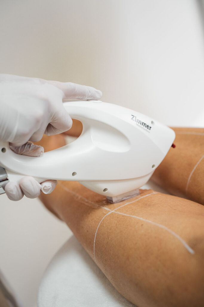 Huidtherapie behandeling in Hoeksche Waard